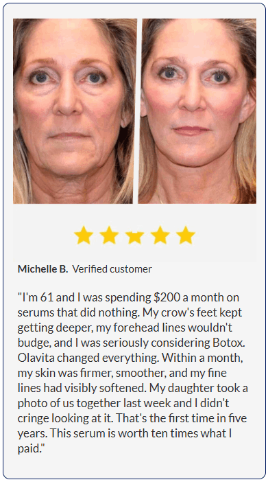Second verified Luminara before and after skin results