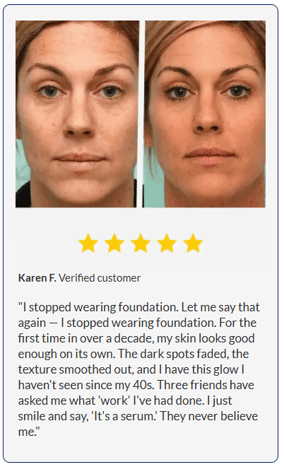 Verified Luminara before and after skin results